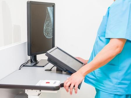 Doctor looking at mammogram snapshot
