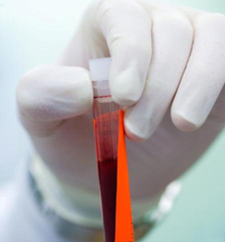 Bloodborne diseases