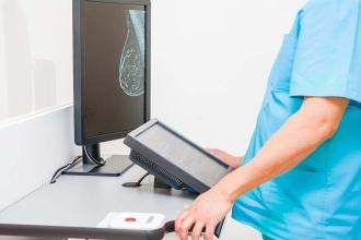 Doctor looking at mammogram