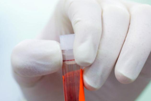 Bloodborne diseases
