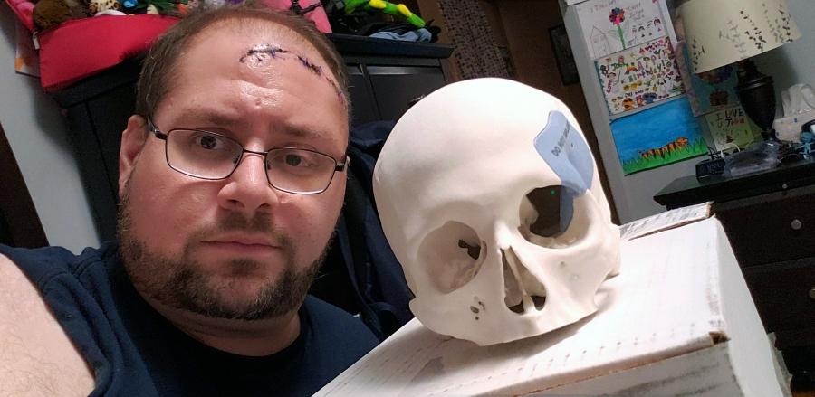 Staten Island Technical HS teacher Joe Buro with the 3D replica of his skull that he uses in his computer-aided design class.
