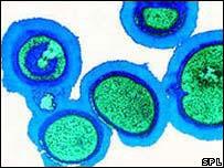 Staphylococcus (MRSA) bacteria
