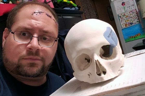 Staten Island Technical HS teacher Joe Buro with the 3D replica of his skull that he uses in his computer-aided design class.