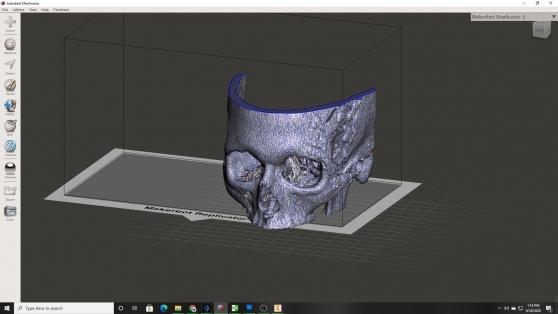 The printable model of his skull, which used Buro’s CAT scan data.